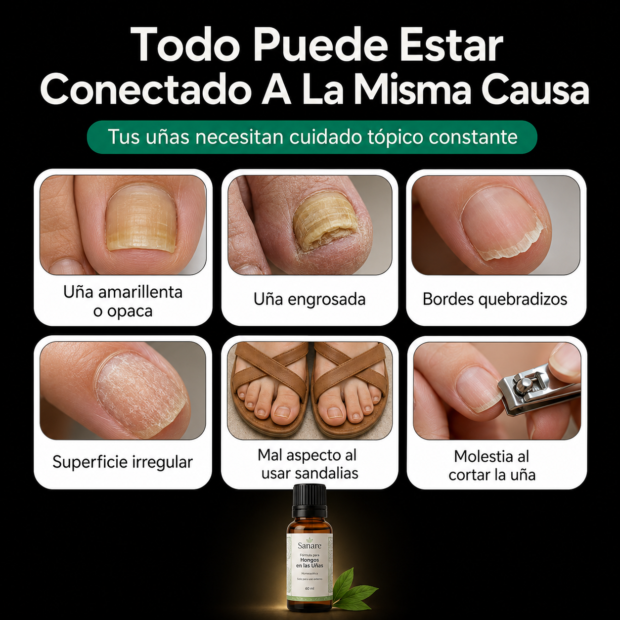 Sanare™ Fórmula para Hongos en las Uñas – 60 ml