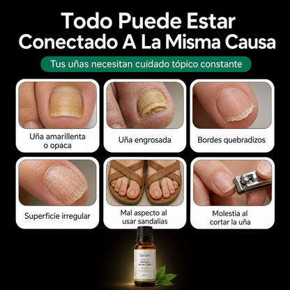 Sanare™ Fórmula para Hongos en las Uñas – 60 ml