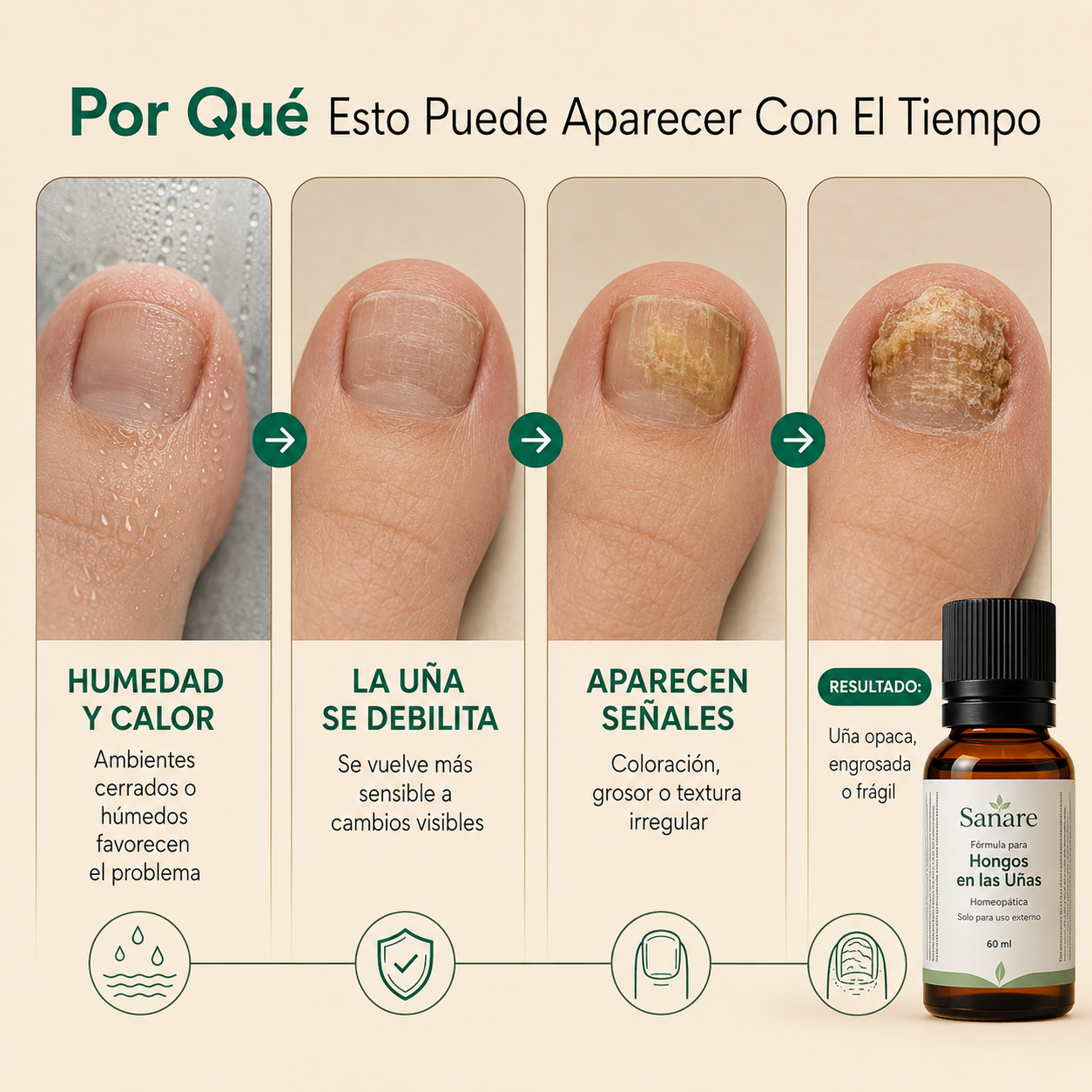 Sanare™ Fórmula para Hongos en las Uñas – 60 ml